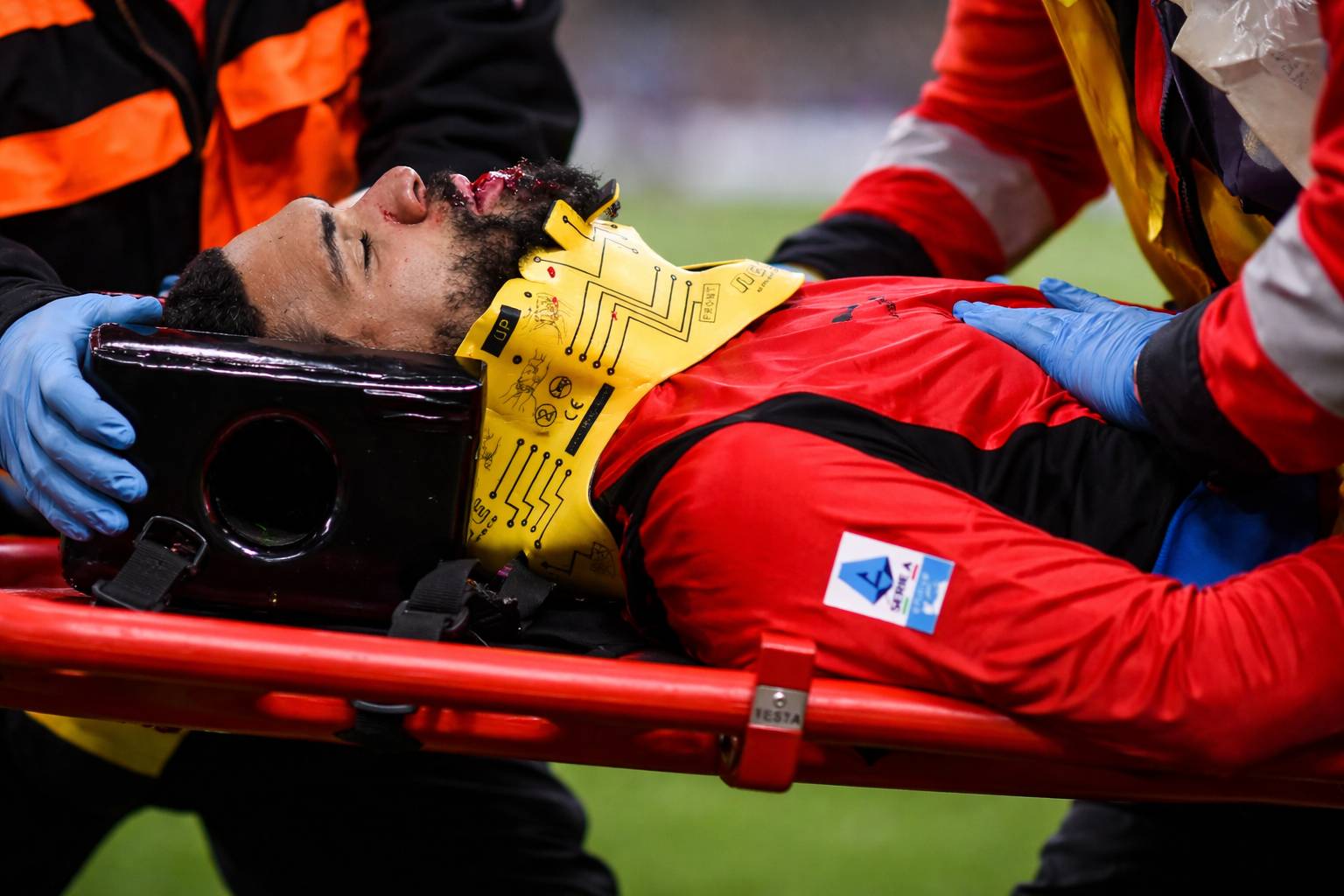 Loftus-Cheek hospitalizado tras accidente en derrota del Milan ante el Parma